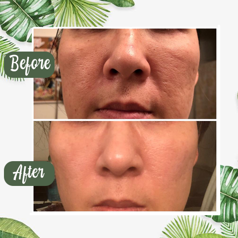 Buy 1 Get 1 Free 49%off - Green Tea Deep Cleanse Mask
