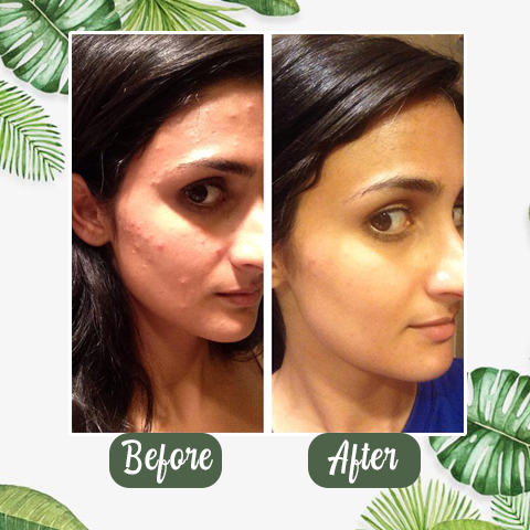 Buy 1 Get 1 Free 49%off - Green Tea Deep Cleanse Mask