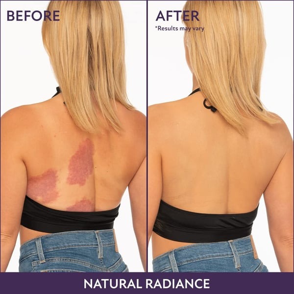 Hot Sale 49%off- Cover Skin Body Concealer