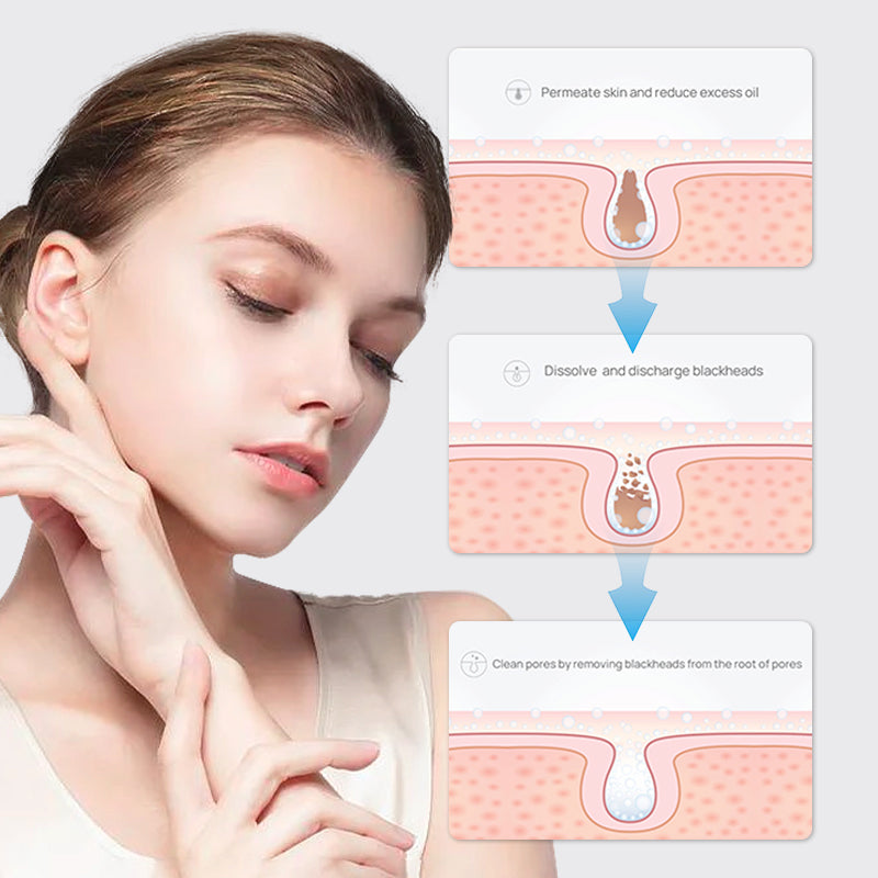 Eyeworldpark™ Blackhead Removal Nose Mask - Intense Cleansing, Sensitive Skin-Friendly