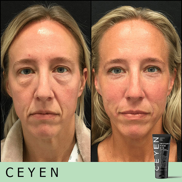 Hot Sale 49% OFF - Temporary Eye Cream - The Most Effective Solution To Get Rid Of Eye Bags