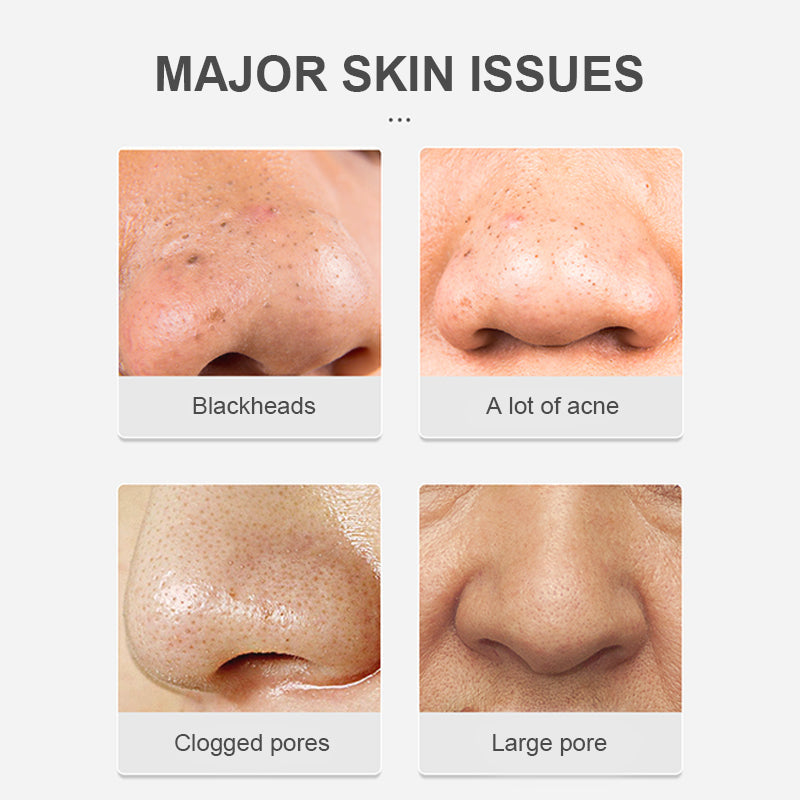 Eyeworldpark™ Blackhead Removal Nose Mask - Intense Cleansing, Sensitive Skin-Friendly