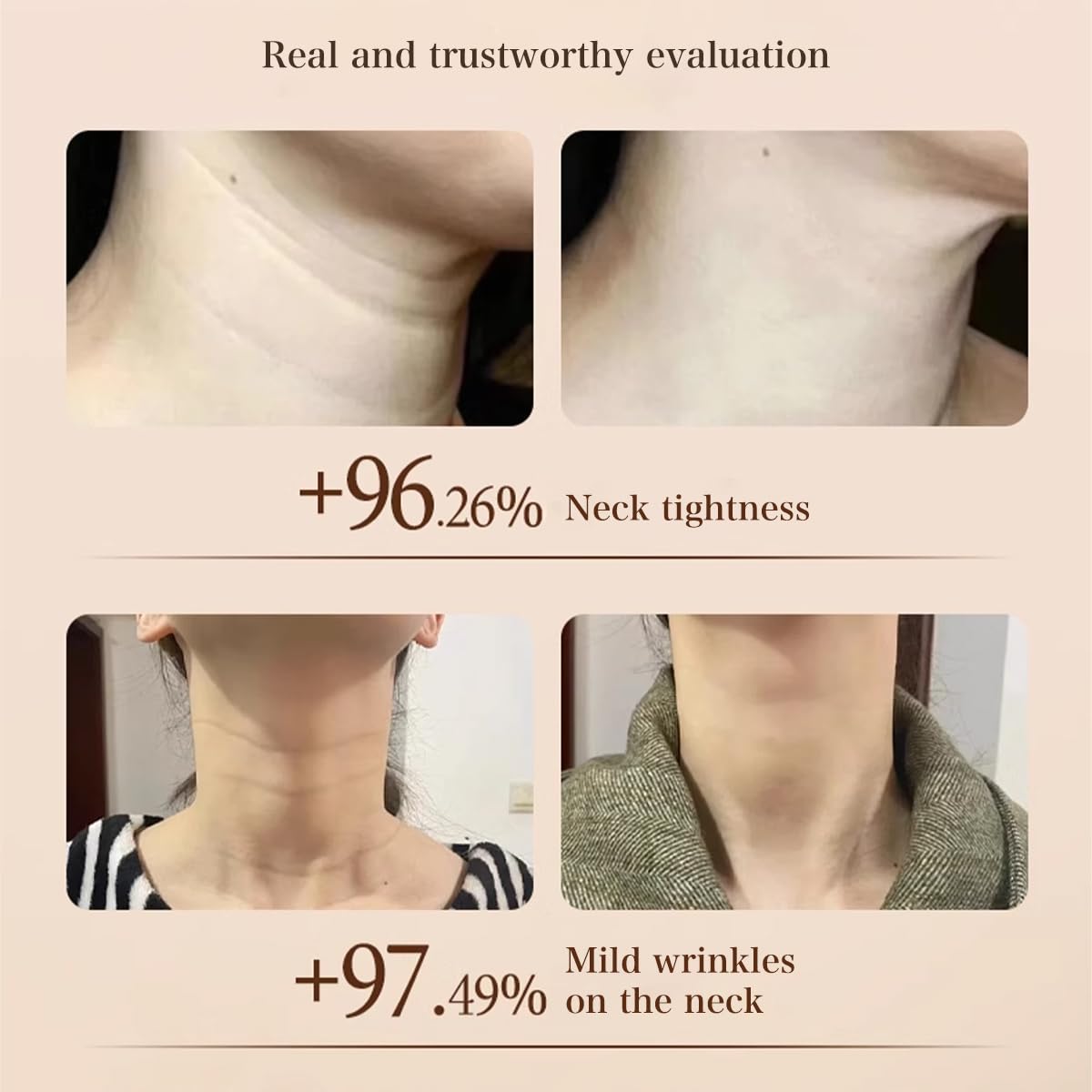 ✨Facial wrinkle cream👩🏻