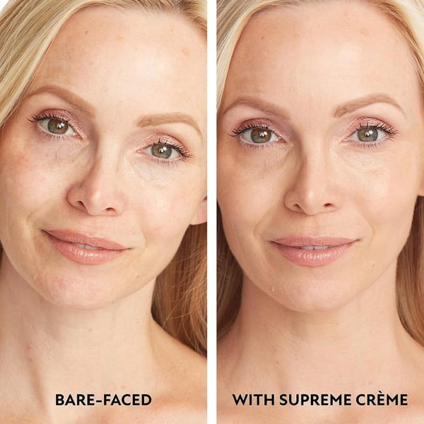 Hot Sale 49%off- Cover Skin Body Concealer