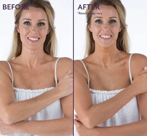 Hot Sale 49%off- Cover Skin Body Concealer