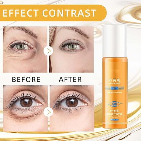 BUY MORE GET MORE FREE 49%off🔥Anti-wrinkle eye serum oil
