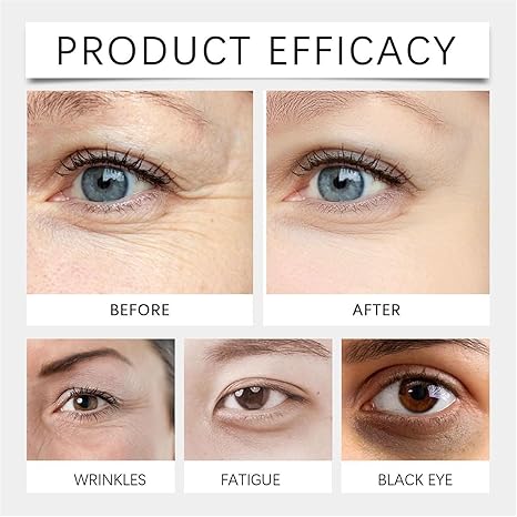 BUY MORE GET MORE FREE 49%off🔥Anti-wrinkle eye serum oil