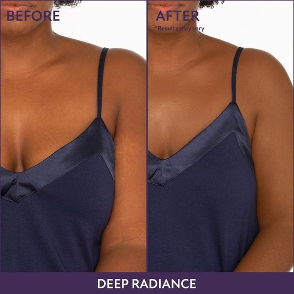 Hot Sale 49%off- Cover Skin Body Concealer