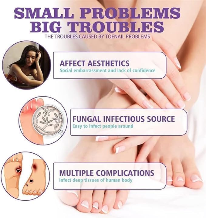 PLANT-BASED ANTI-FUNGAL SPRAY (Clinically Approved)