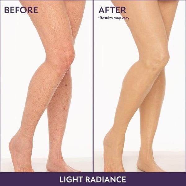 Hot Sale 49%off- Cover Skin Body Concealer