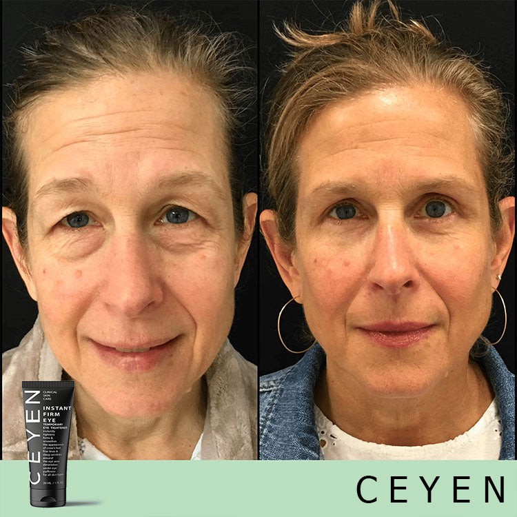 Hot Sale 49% OFF - Temporary Eye Cream - The Most Effective Solution To Get Rid Of Eye Bags