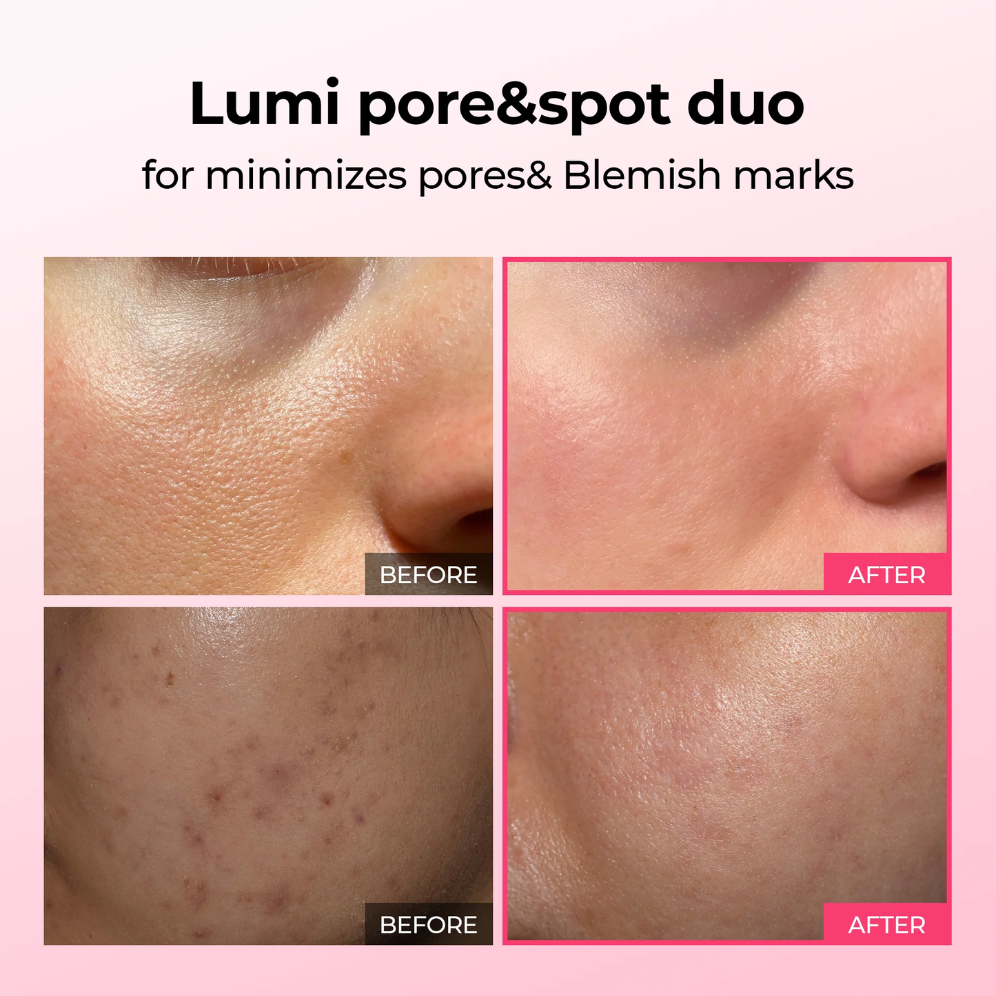 Pore & Spot Duo