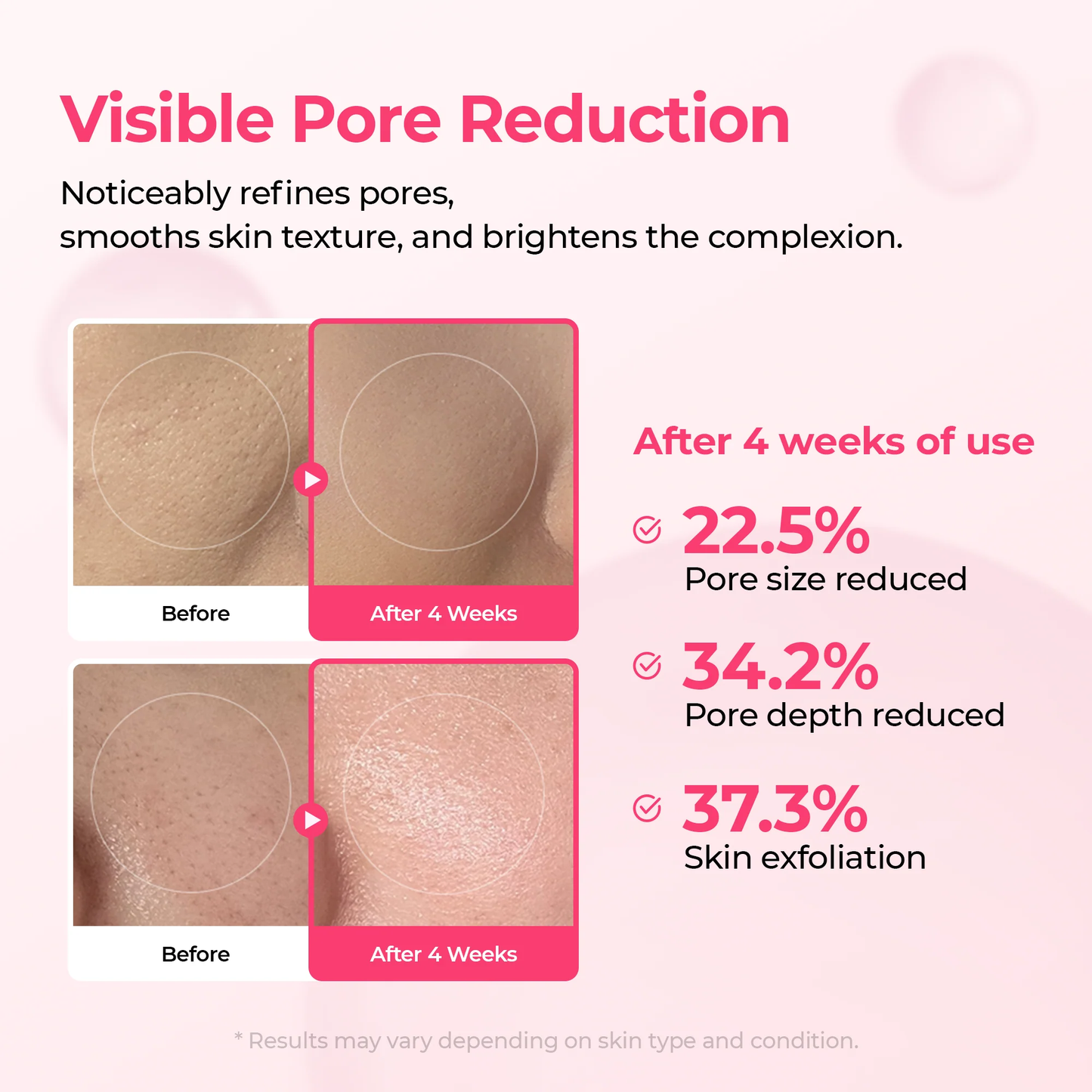 Pore & Spot Duo