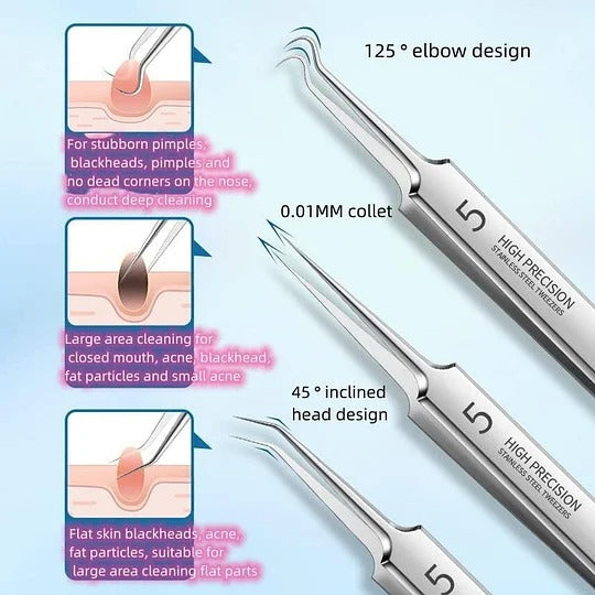 HOT SALE 49% off - Professional Facial Blackhead Remover Tweezers