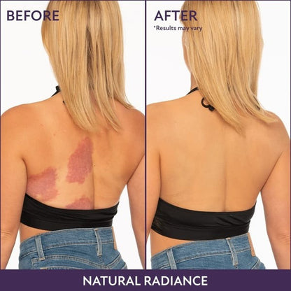 Hot Sale 49%off- Cover Skin Body Concealer
