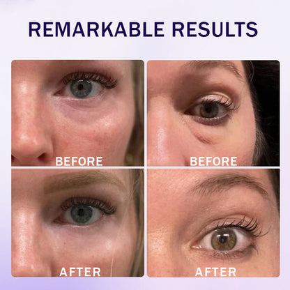 🌸Instant Collagen Infusion Tightening Eye Patches