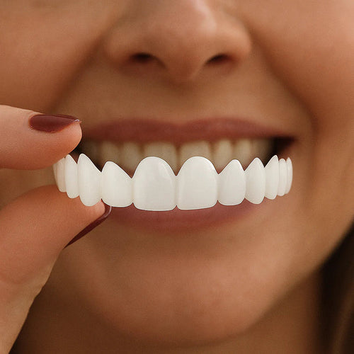 Eyeworldpark Clip-on Veneers