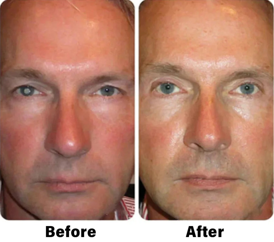 Eyeworldpark™ Nano Vision Repair Eye Serum ✅FDA Approved(Suitable for presbyopia, dry eye syndrome, glaucoma, and cataracts)