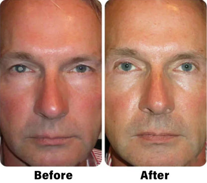 Eyeworldpark™ Nano Vision Repair Eye Serum ✅FDA Approved(Suitable for presbyopia, dry eye syndrome, glaucoma, and cataracts)