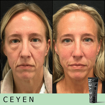 Hot Sale 49% OFF - Temporary Eye Cream - The Most Effective Solution To Get Rid Of Eye Bags