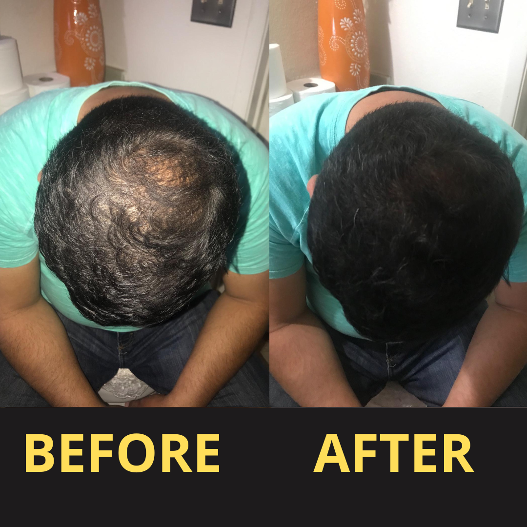 Eyeworldpark Hair Concealer BLACK 50ML - Waterproof 3–7 days