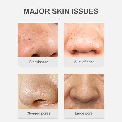 Eyeworldpark™ Blackhead Removal Nose Mask - Intense Cleansing, Sensitive Skin-Friendly