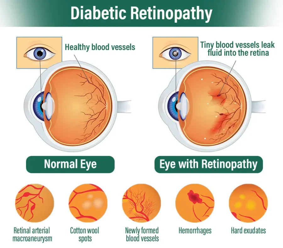 Eyeworldpark™ Nano Vision Repair Eye Serum ✅FDA Approved(Suitable for presbyopia, dry eye syndrome, glaucoma, and cataracts)