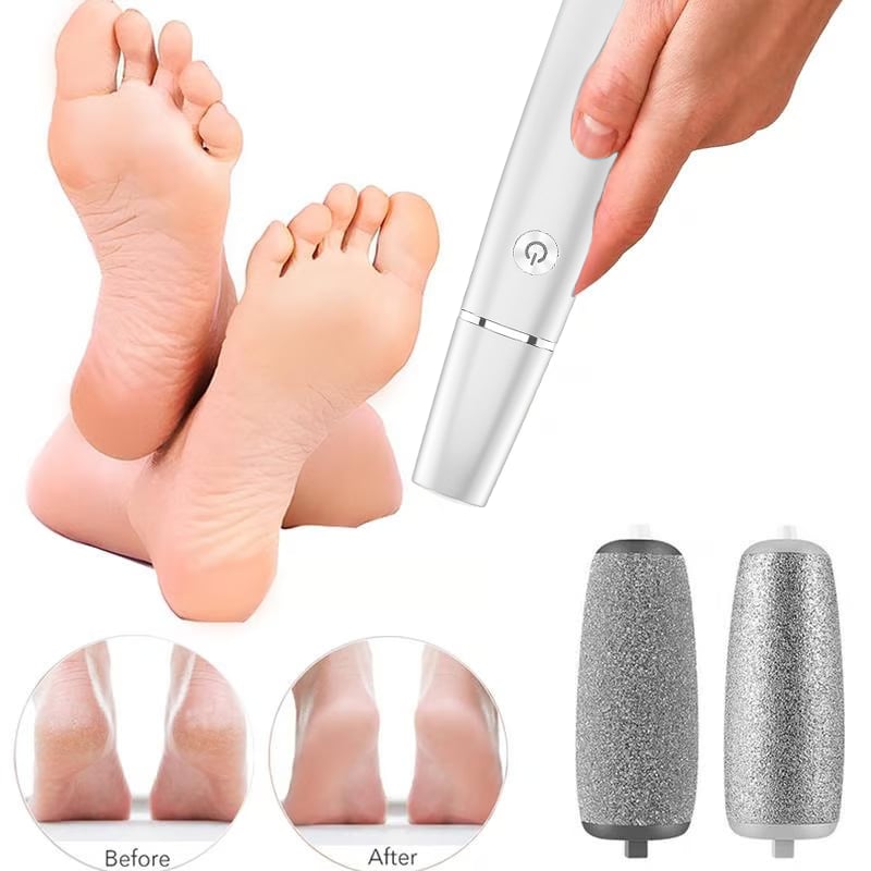 Hot Sale - 49% OFF🌸Electric Feet Callus Remover