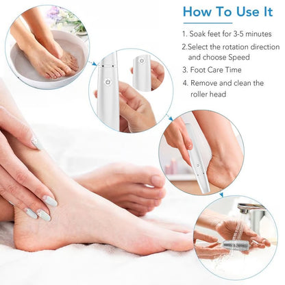Hot Sale - 49% OFF🌸Electric Feet Callus Remover