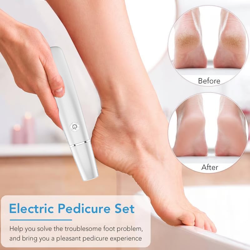 Hot Sale - 49% OFF🌸Electric Feet Callus Remover