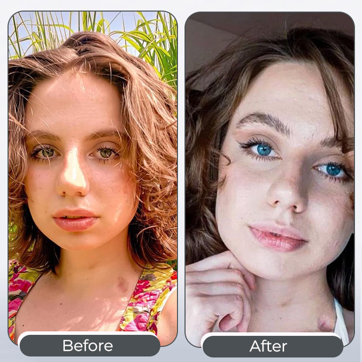 HOT SALE 49% OFF - Miracle eye drops-that can change the color of your eyes