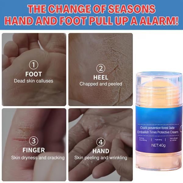 Foot Rejuvenation Cream - Remove dead skin and moisturize dry skin