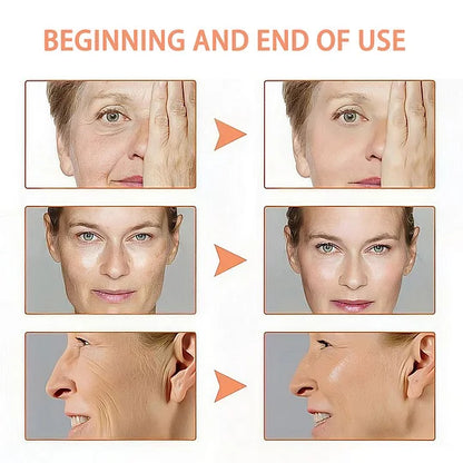 🌹Hot Sale 49% OFF👩‍🦳Botox Anti-Aging Moisturizing Serum