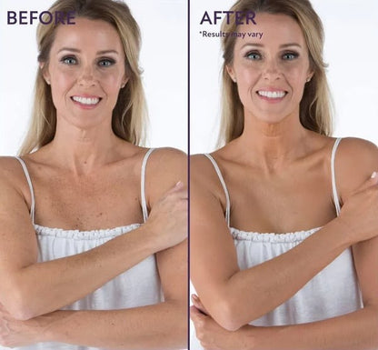Hot Sale 49%off- Cover Skin Body Concealer