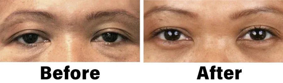 Eyeworldpark™ Nano Vision Repair Eye Serum ✅FDA Approved(Suitable for presbyopia, dry eye syndrome, glaucoma, and cataracts)