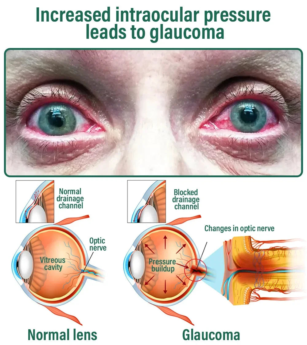 Eyeworldpark™ Nano Vision Repair Eye Serum ✅FDA Approved(Suitable for presbyopia, dry eye syndrome, glaucoma, and cataracts)