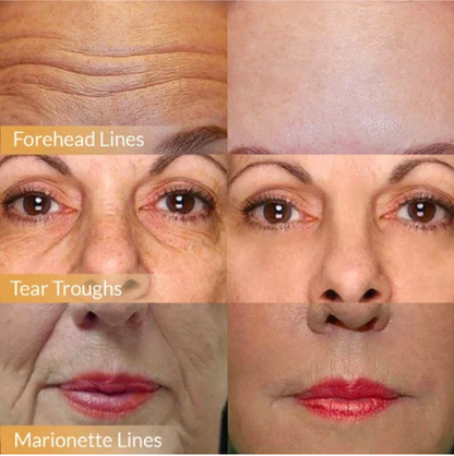 🎁 Buy 2 get 1 free 🎁 Polypeptide Firming Full Face Cream