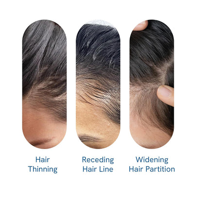 Hair Growth Roll-On