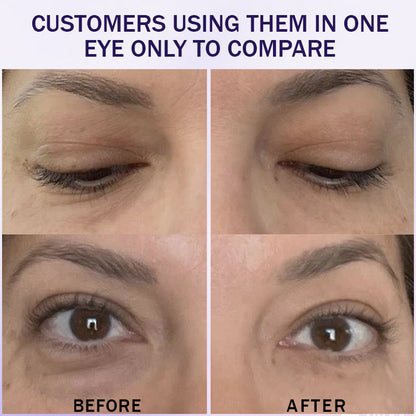 🌸Instant Collagen Infusion Tightening Eye Patches