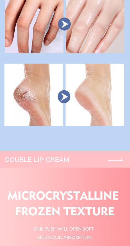 Foot Rejuvenation Cream - Remove dead skin and moisturize dry skin