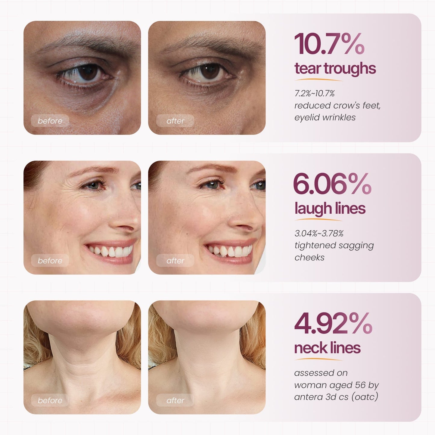 Cemenrete Calcium Multi Balm | Anti-aging, Sagging, Wrinkles