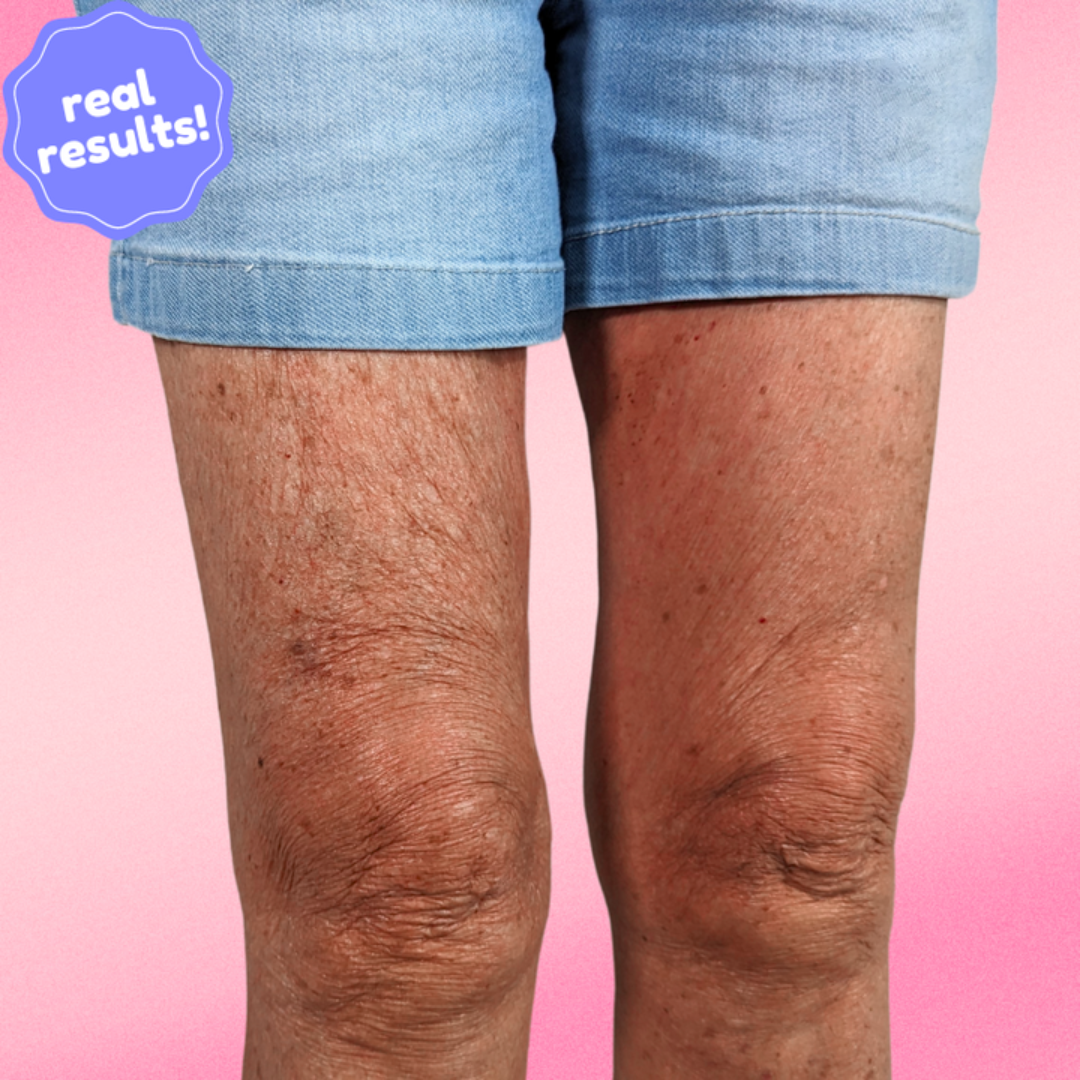 Instant Lift & Glow – Invisible Firming Patches