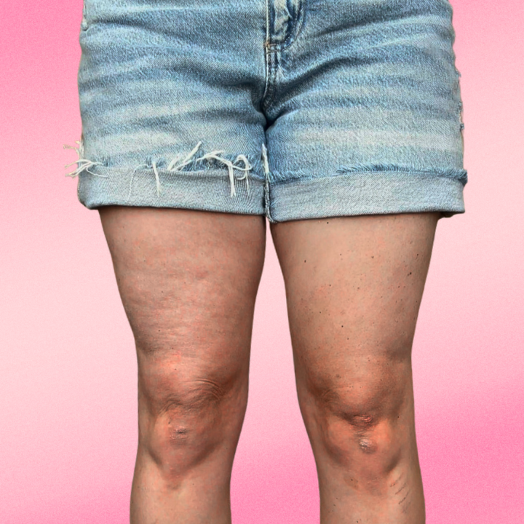 Instant Lift & Glow – Invisible Firming Patches