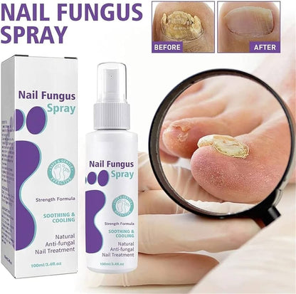 PLANT-BASED ANTI-FUNGAL SPRAY (Clinically Approved)