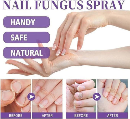 PLANT-BASED ANTI-FUNGAL SPRAY (Clinically Approved)