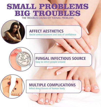 PLANT-BASED ANTI-FUNGAL SPRAY (Clinically Approved)