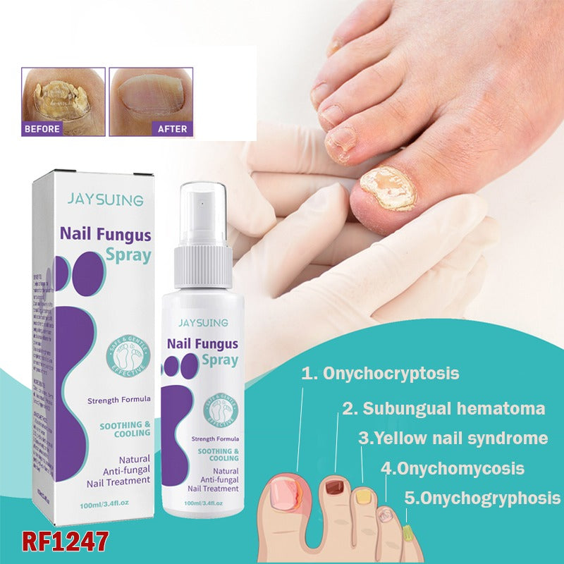 PLANT-BASED ANTI-FUNGAL SPRAY (Clinically Approved)