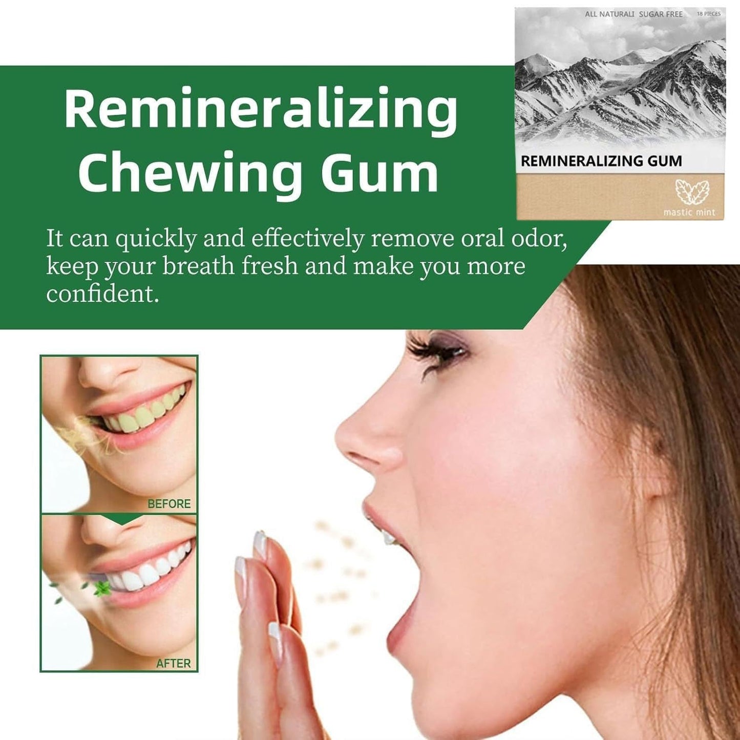 Remineralizing Gum