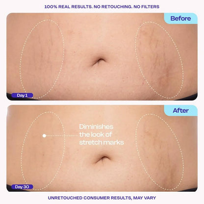 Tighten & Smooth Belly Cream