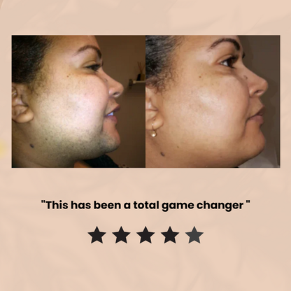 BUY 1 GET 1 FREE 49%off Hair Removal Kit